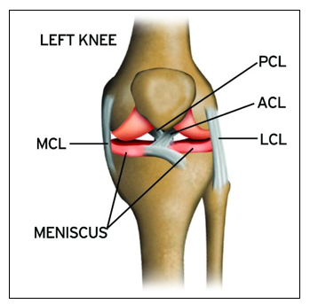 Managing your Medial Knee Pain: MCL injuries